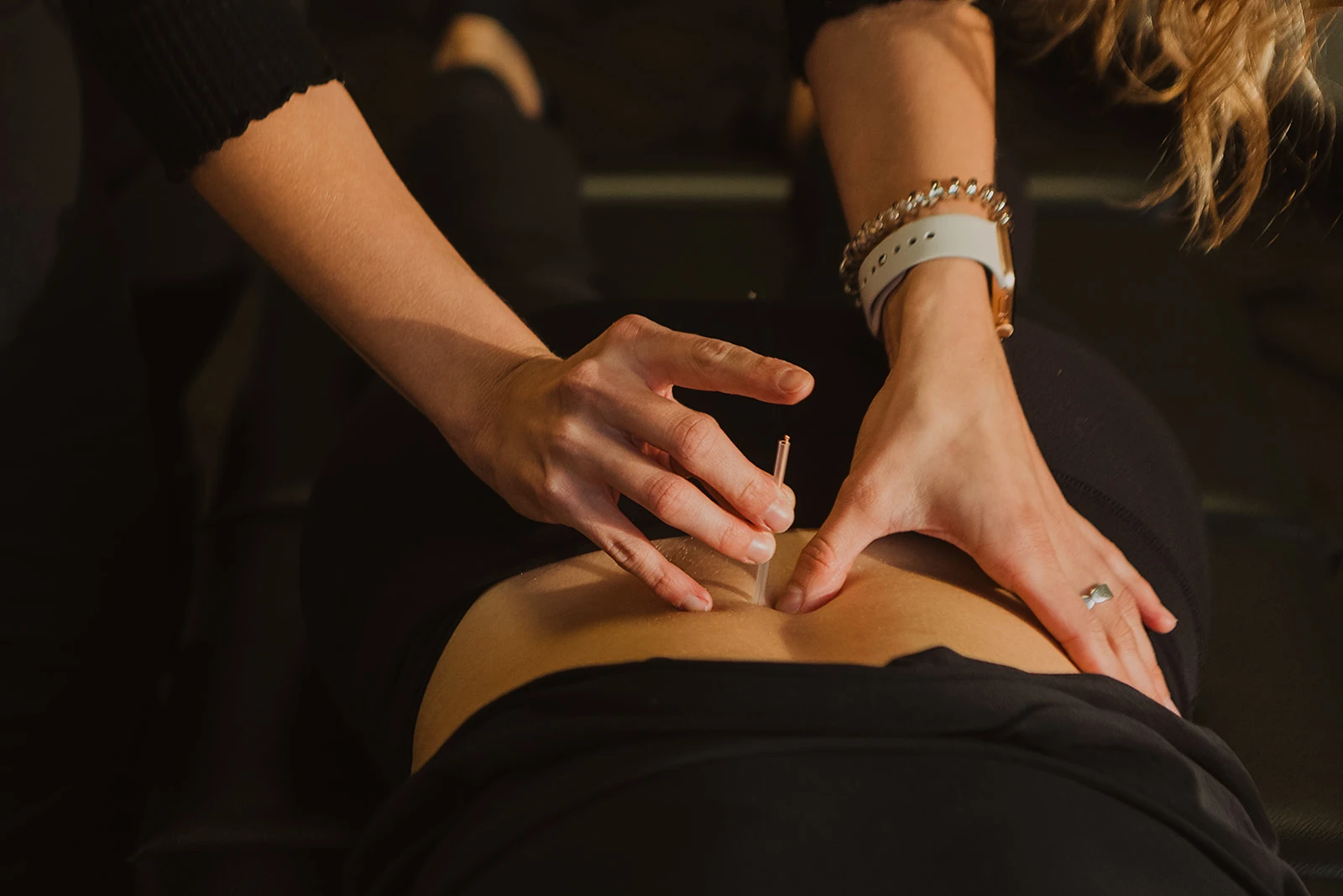 Acupuncture Clinic Calgary