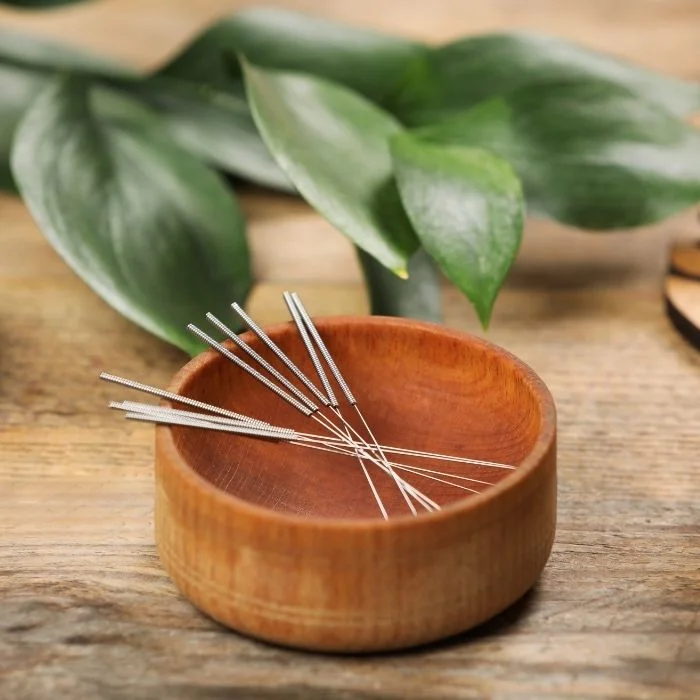 Sterile acupuncture needles prepared for treatment session