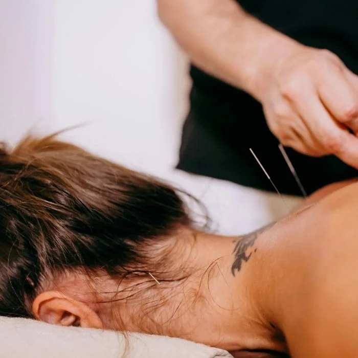 Patient receiving acupuncture treatment on neck and shoulder area