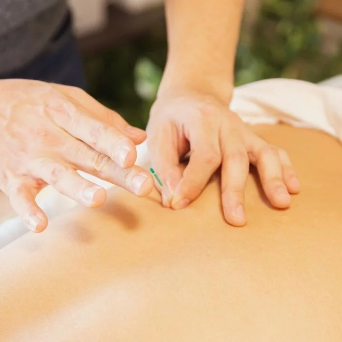 Acupuncturist inserting needle into patient’s back for pain management treatment